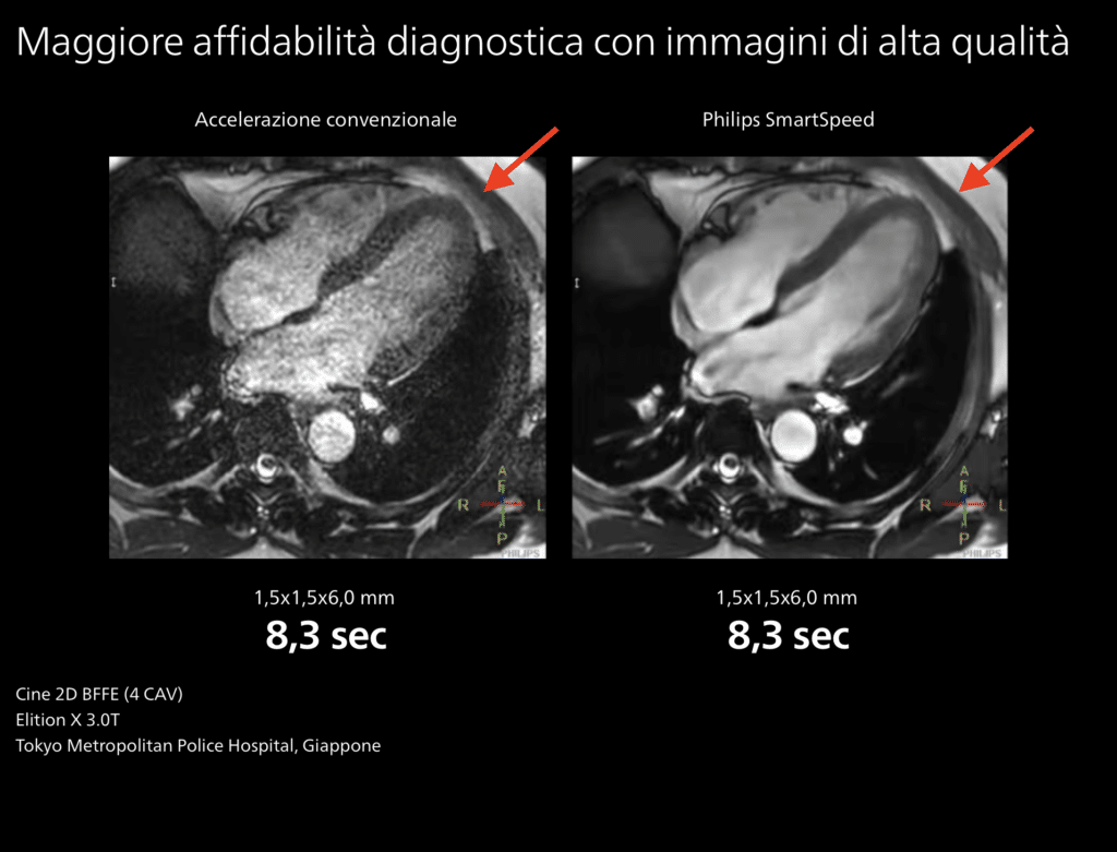 risonanza magnetica con intelligenza artificiale