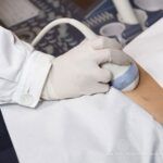 Conteggio dei Follicoli Ovarici