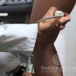 Ecocolordoppler Arti Inferiori