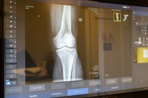 Radiografia Ossea (SSN) radiologia digitale diagnostica per immagini