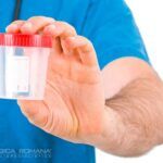 Esame Tossicologico Su Urine