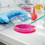 Esame Stress Ossidativo