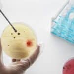 Test Rapido Dell’Ureasi Per HP