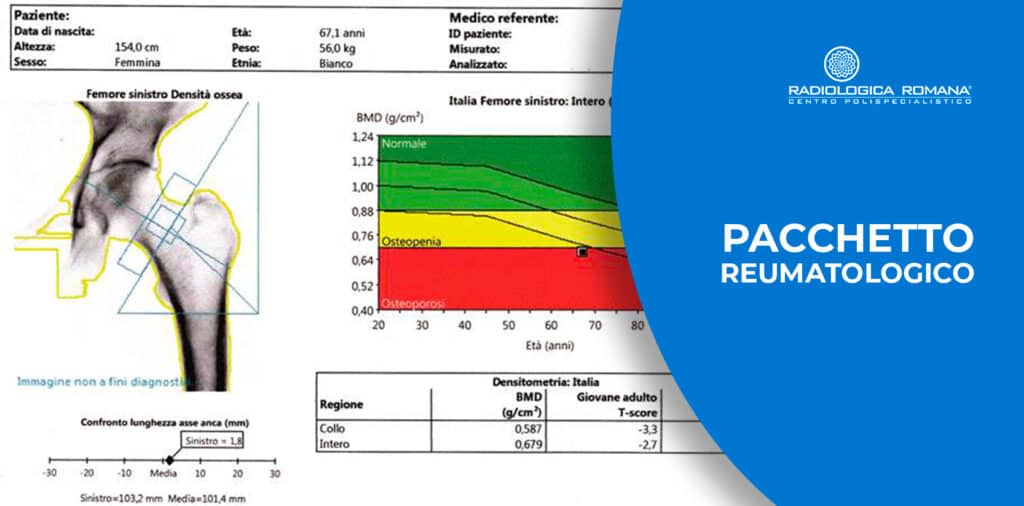 pacchetto reumatologico moc lombare e femorale + visita di controllo moc